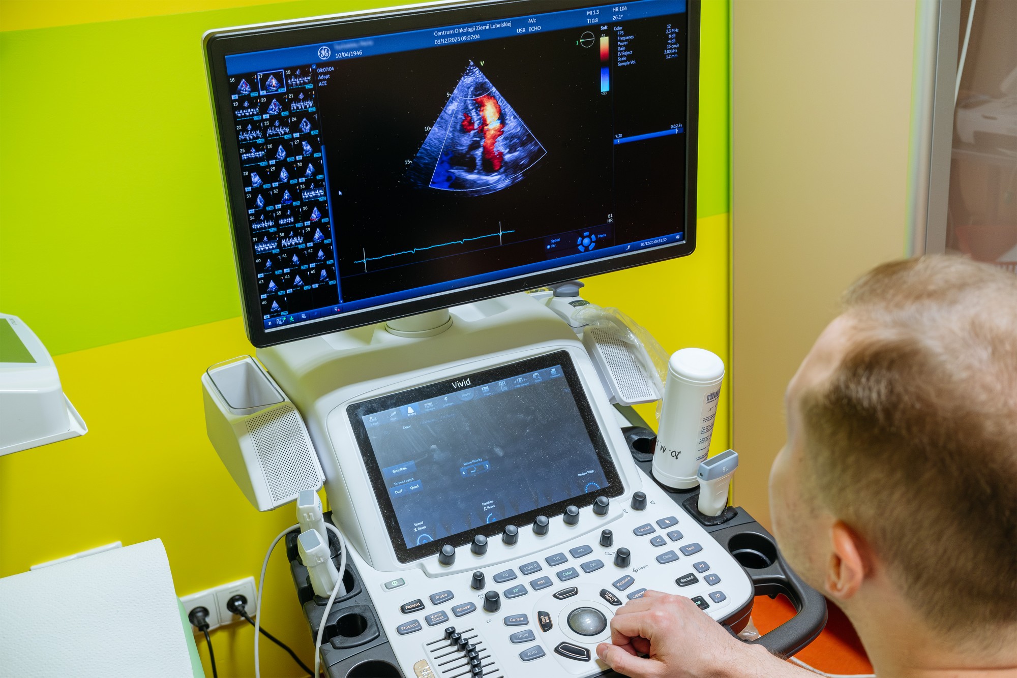 DSCF6671 Niestandardowe